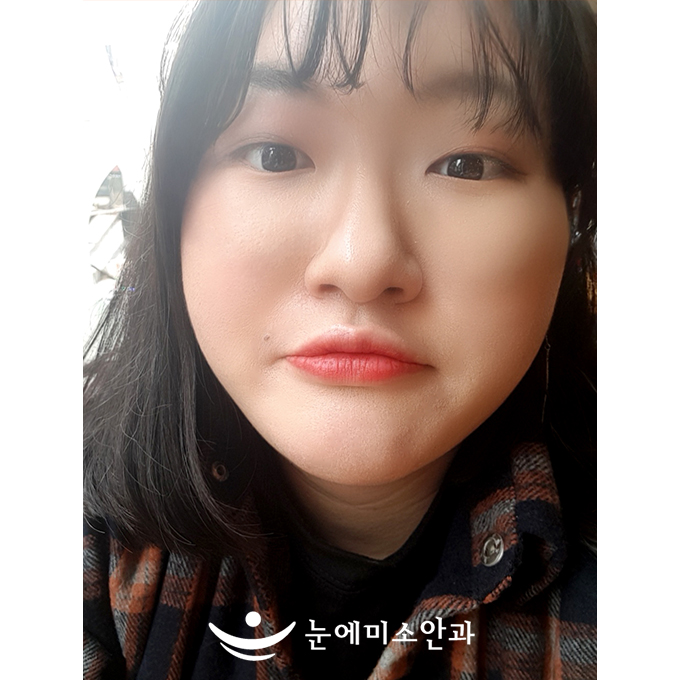 할까 말까 고민 중이시라면 빨리 하시라고 말씀드리고 싶어요!